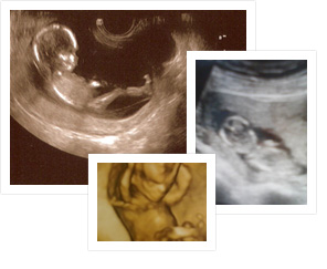 12 неделя беременности фото узи