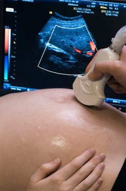 Ультразвуковое исследование (УЗИ) при беременности