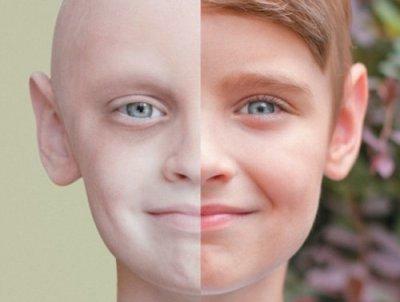 До и после рака: уникальное фото ребенка